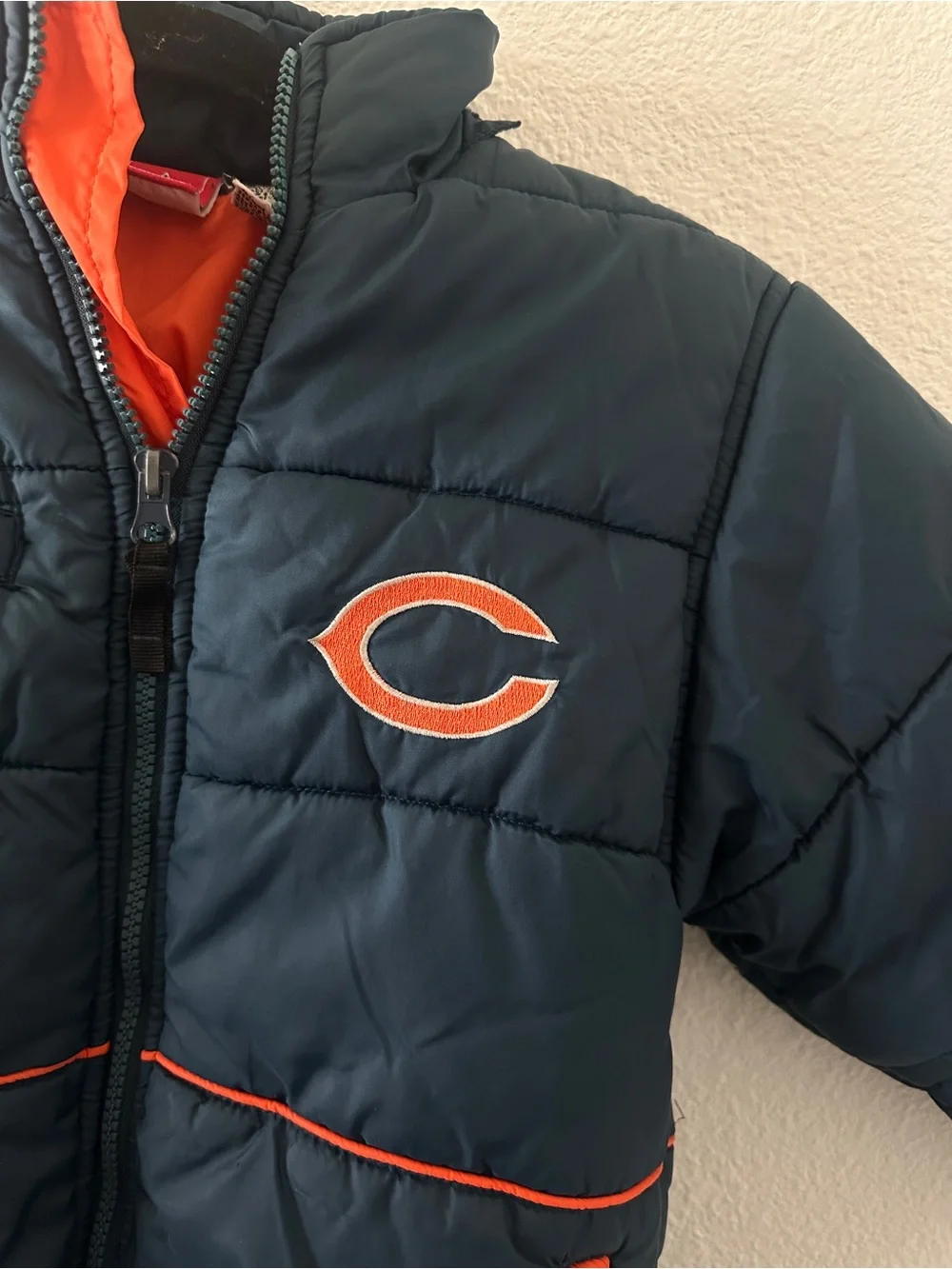 NFL slight discoloration